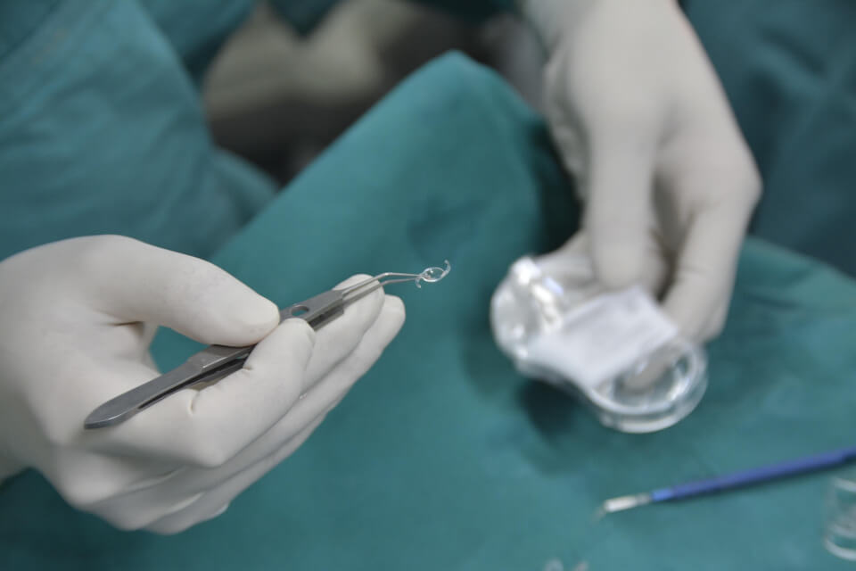 Multifocal Intraocular Lens (IOL) Prepared for Implantation