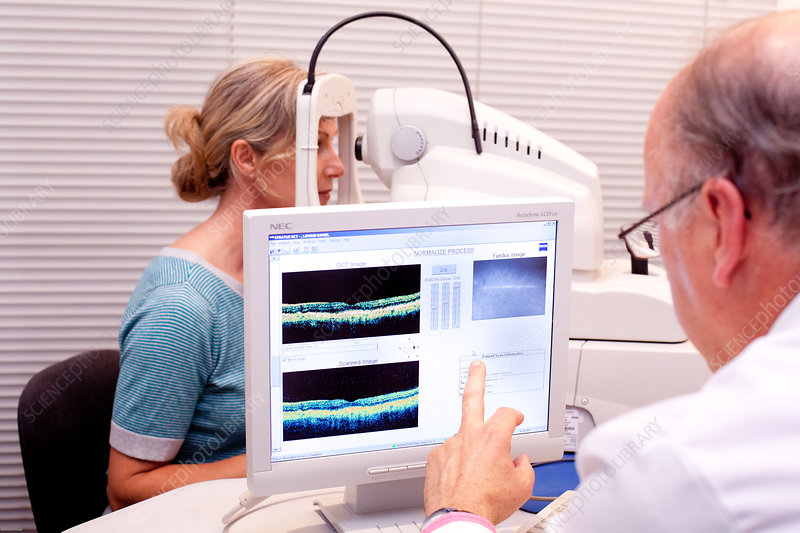 Retina specialist reviewing OCT scan for macular degeneration diagnosis